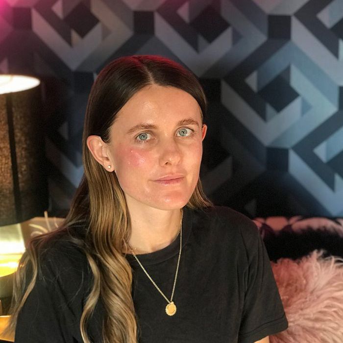 萨沙Strebe预估激光审查